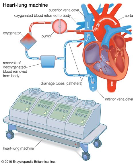 centrifugal pump in heart lung machine|lung oxygenator machine.